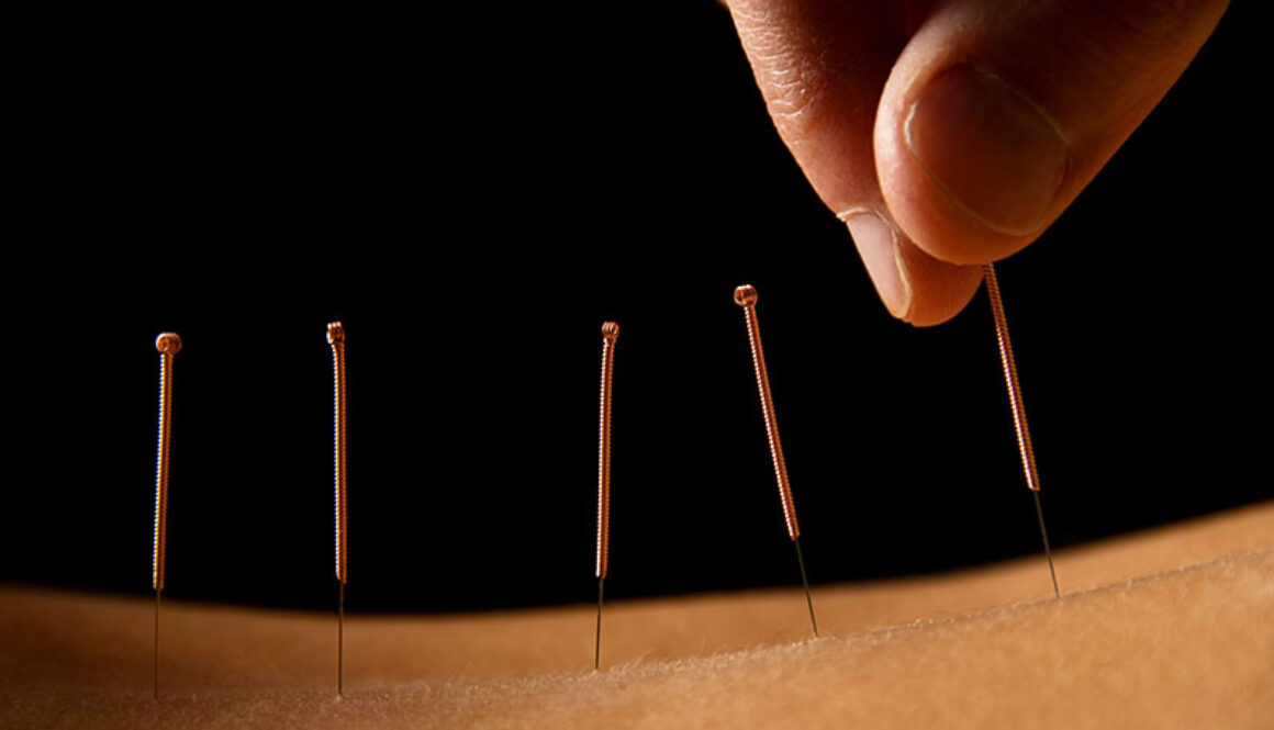 Acupuncture Needle Size